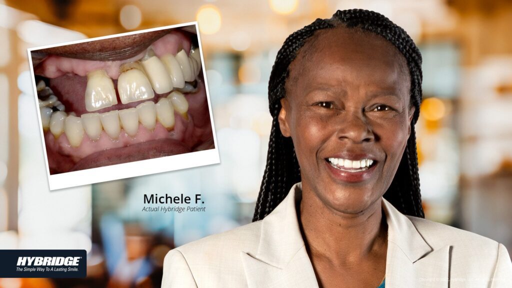 before-after_smile_gallery_michelle-f.jpg