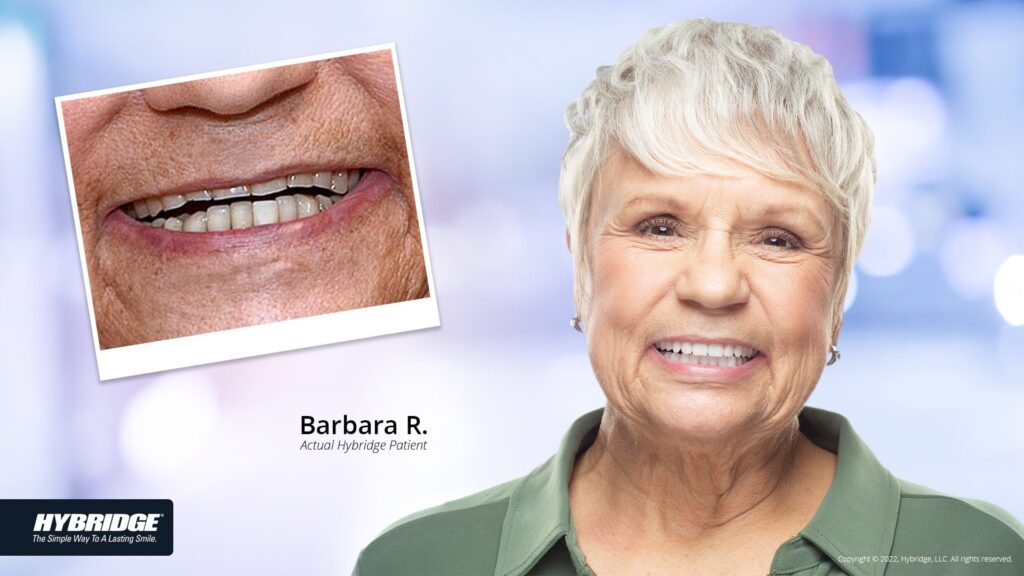 before-after_smile_gallery_w-bkgds_barb-r_1920x1080.jpg