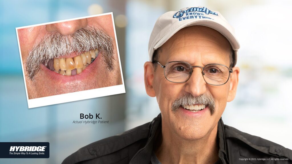 before-after_smile_gallery_w-bkgds_bob_1920x1080.jpg