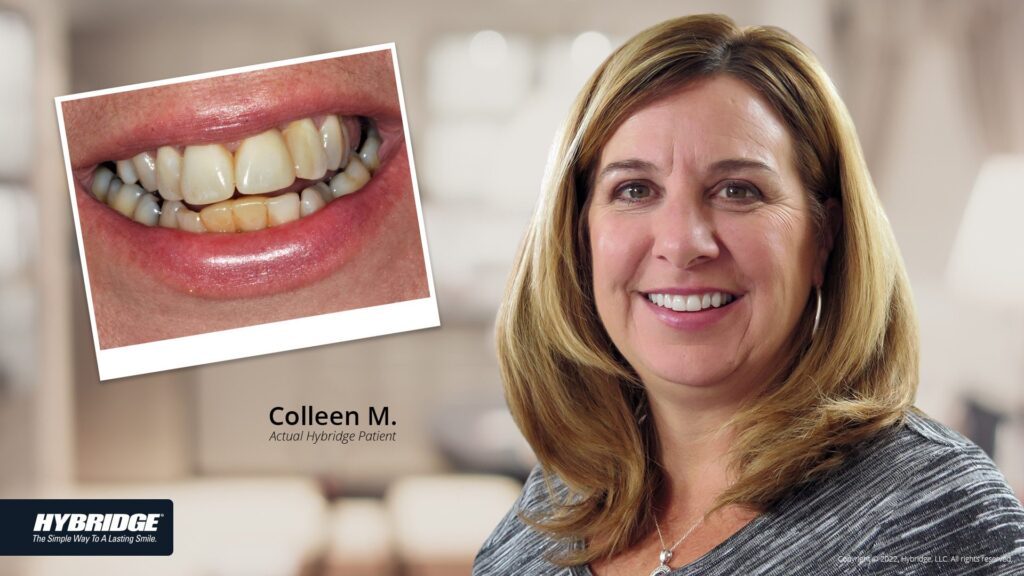 before-after_smile_gallery_w-bkgds_colleen-m_1920x1080_3.jpg