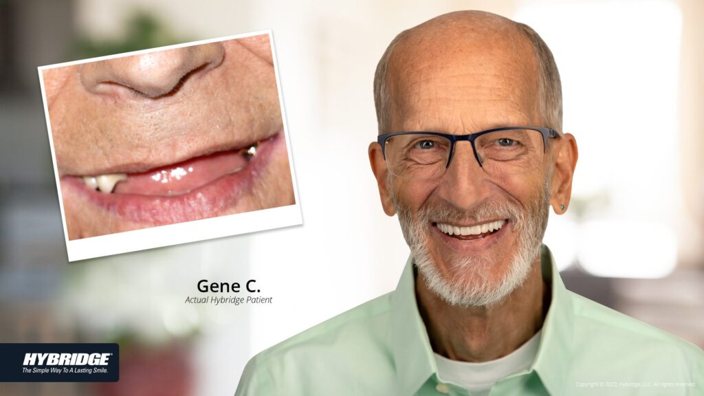 before-after_smile_gallery_w-bkgds_gene_1920x1080.jpg