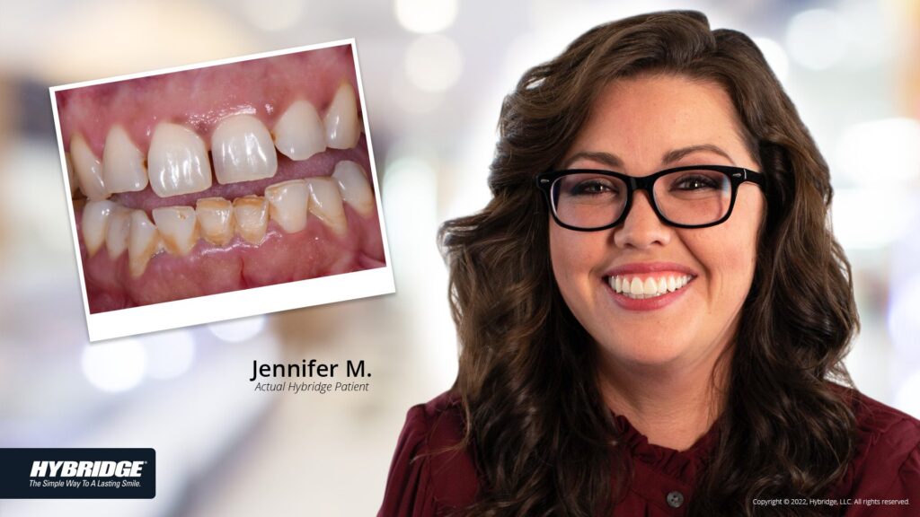 before-after_smile_gallery_w-bkgds_jennifer-m_1920x1080_2.jpg