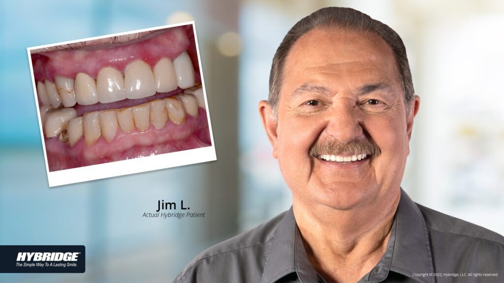 before-after_smile_gallery_w-bkgds_jim-l_1920x1080_2.jpg