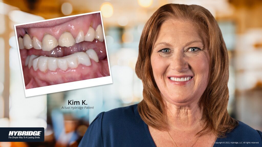 before-after_smile_gallery_w-bkgds_kim-k_1920x1080_21.jpg