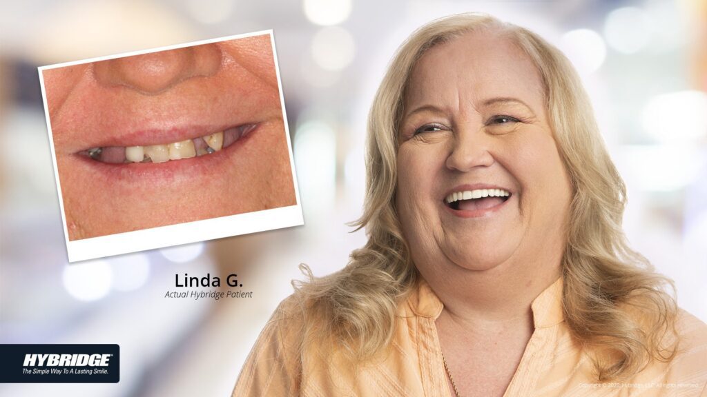 before-after_smile_gallery_w-bkgds_linda-g_1920x1080.jpg