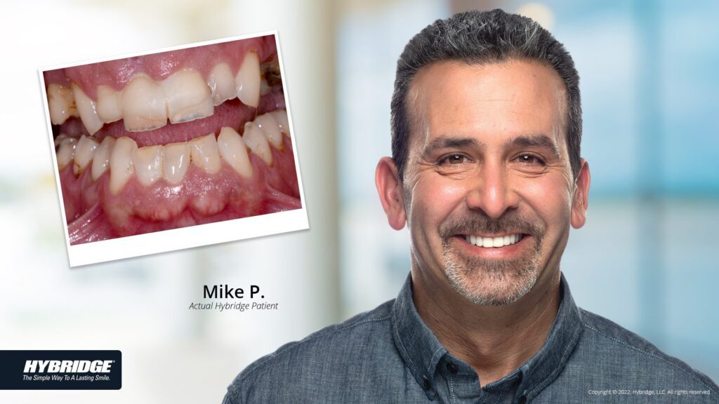 before-after_smile_gallery_w-bkgds_mike-p_1920x1080_2.jpg