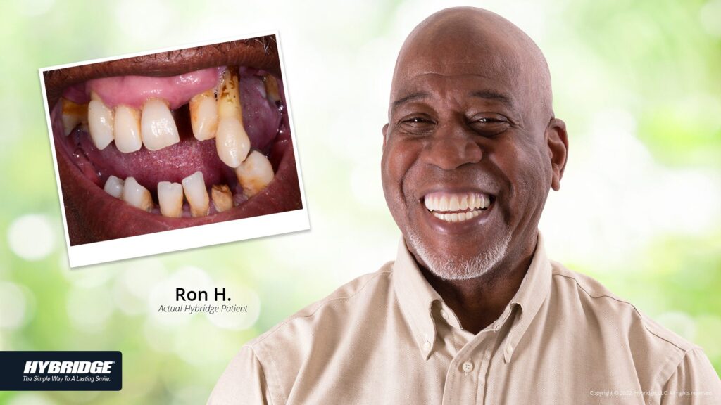 before-after_smile_gallery_w-bkgds_ron-h_1920x1080.jpg