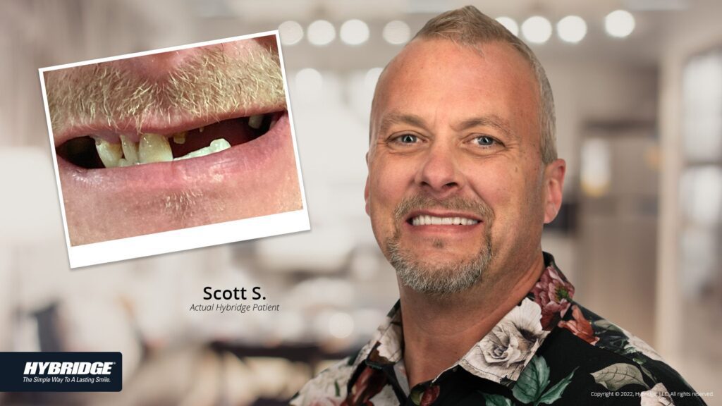 before-after_smile_gallery_w-bkgds_scott-s_1920x1080.jpg