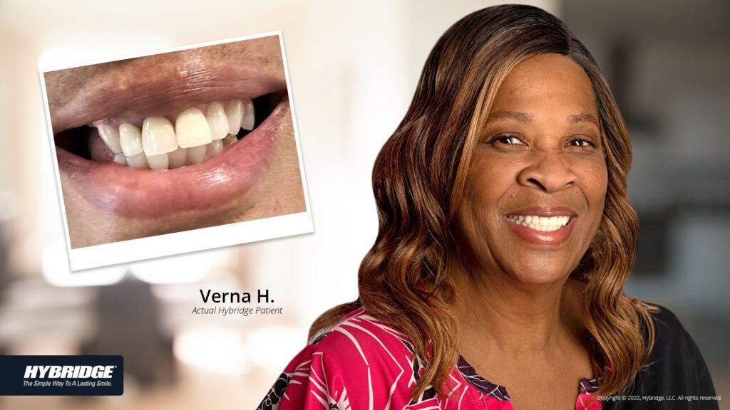 before-after_smile_gallery_w-bkgds_verna_1920x1080.jpg